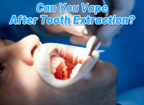 can you vape after tooth extraction
